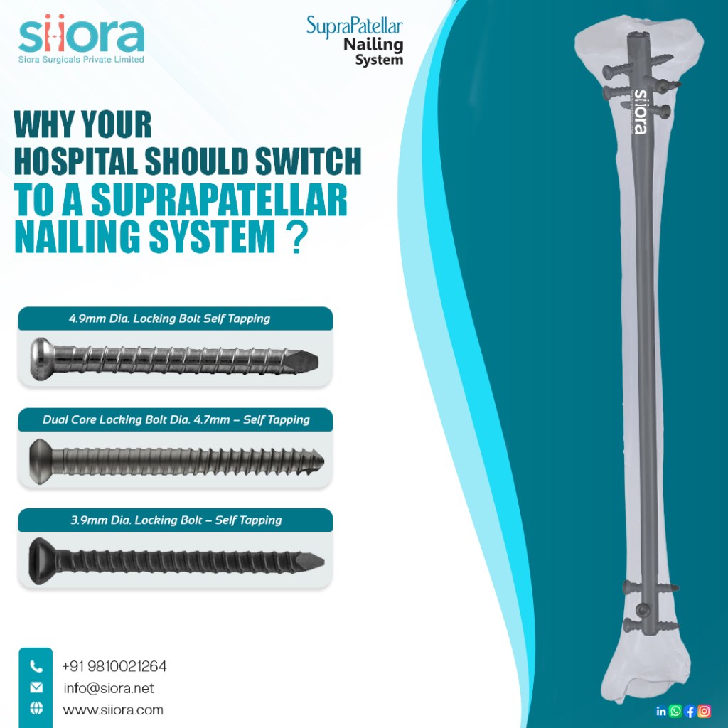 Why Your Hospital Should Switch to a Suprapatellar Nailing System