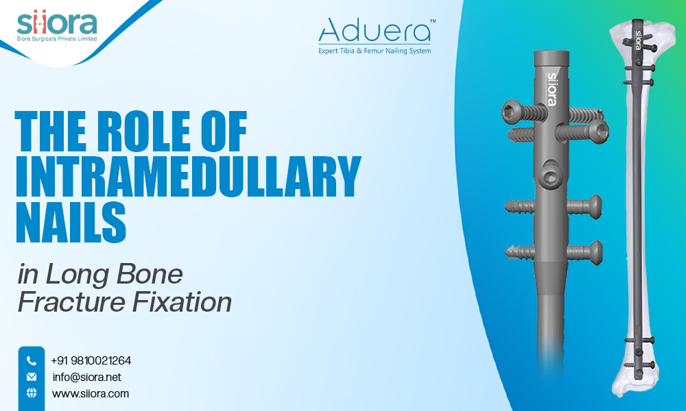 The Role of Intramedullary Nails in Long Bone Fracture Fixation